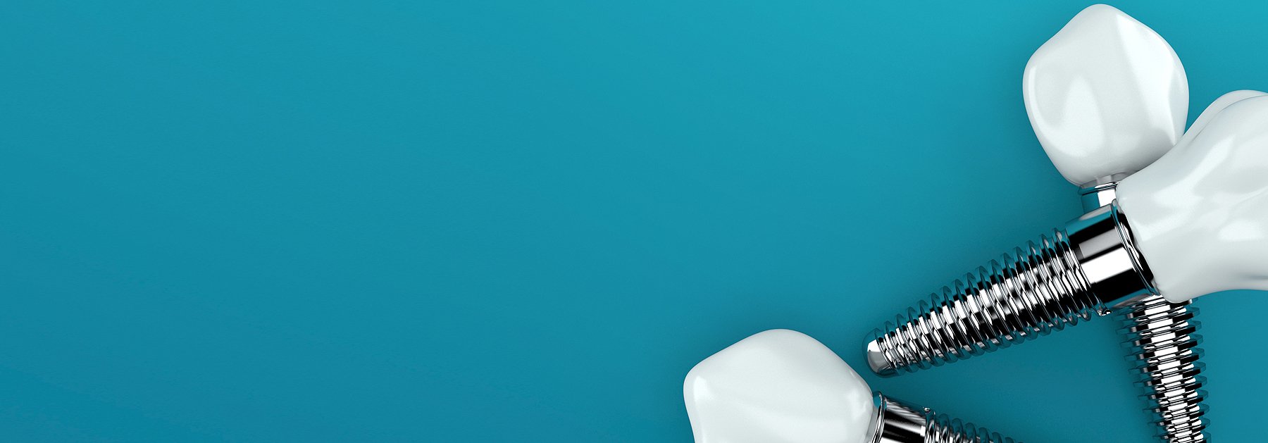 İmplant Sektöründe Son Gelişmeler